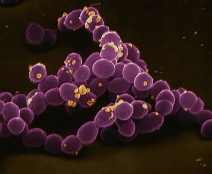 Image: Colored scanning electron micrograph (SEM) of Enterococcus faecalis bacteria (Photo courtesy of the Eye of Science). Image: Colored scanning electron micrograph (SEM) of Enterococcus faecalis bacteria (Photo courtesy of the Eye of Science).